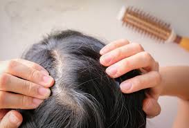 Pousse cheveux grossesse et allaitement : produits compatibles et interdits